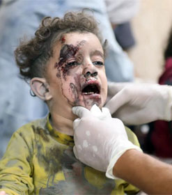 Wounded Gazan child